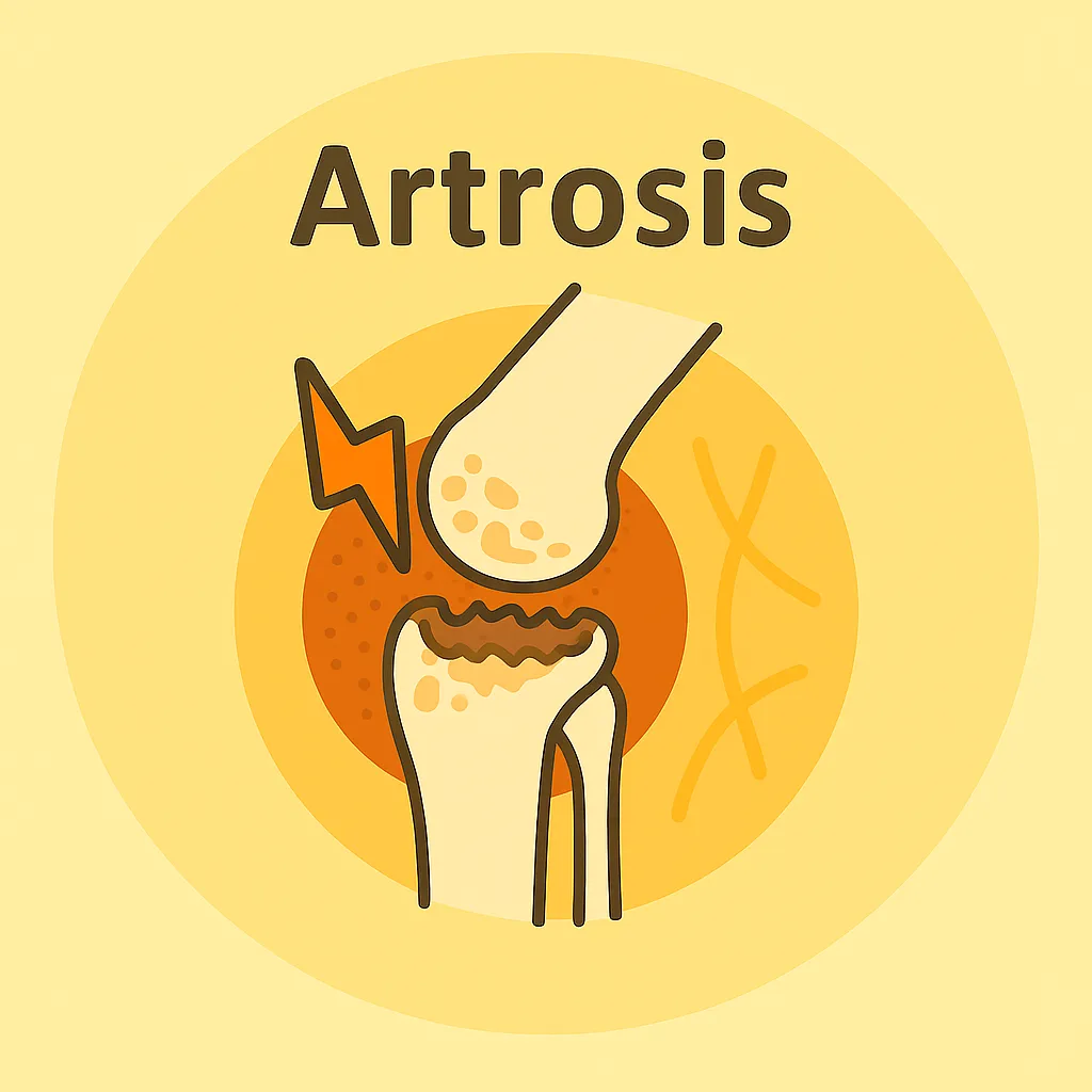 Rodilla con zona inflamada y signos de dolor. Representa el desgaste articular y la artrosis.